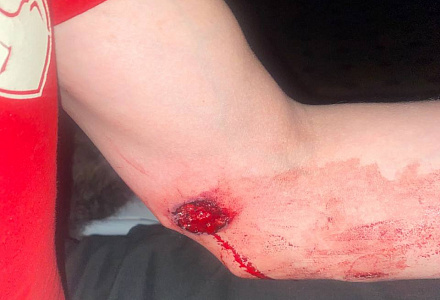 Стрелок, ранивший из пистолета гвардейца, задержан